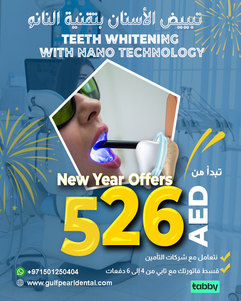 Offer3